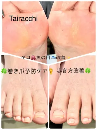 ネイル Tairacchi ﾀｲﾗｯﾁのエステ・リラクイメージ