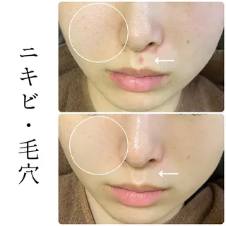 ハーブピーリング専門 BIOEL横浜のエステ・リラクイメージ