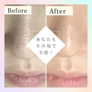 毛穴専門店Bebe 蘭のエステ・リラクイメージ