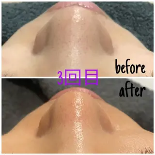 アルカンジュ~archange~所属・痩身/毛穴洗浄/脱毛 アルカンジュのエステ・リラクイメージ