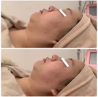 ララ/ハーブ メゾンリュバンのエステ・リラクイメージ