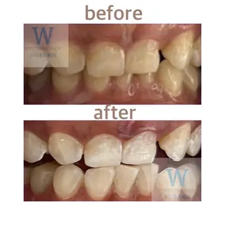 ホワイトニング ショップ本八幡店のエステ・リラクイメージ