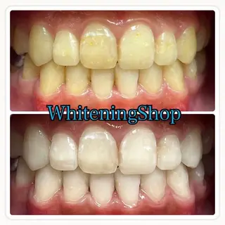 ホワイトニング ショップ吉祥寺店のエステ・リラクイメージ