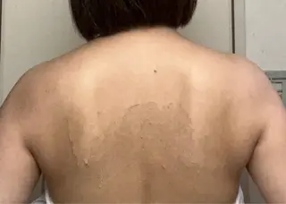 clé skin 🌿ハーブピーリングのエステ・リラクイメージ