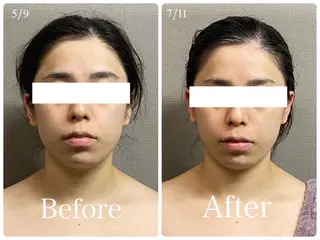 MIRAI小顔 溝の口店のエステ・リラクイメージ