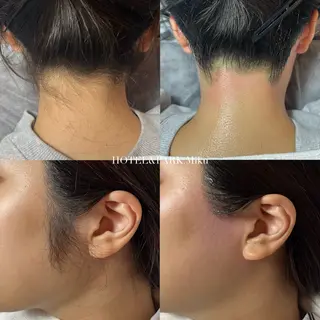 HOTEL&PARK Mikuワックス脱毛のエステ・リラクイメージ