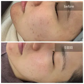 トータルしみケア専門 NICA(ニカ)のエステ・リラクイメージ