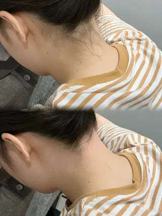 脱毛サロンBloom所属・脱毛屋さん/池袋 /Bloom🍋わだのエステ・リラクイメージ