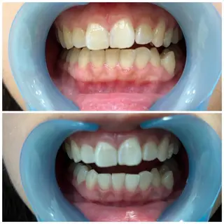 プライベートサロン Lｏｋａｈｉ飯生透のエステ・リラクイメージ