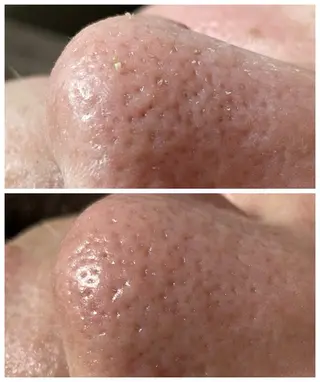 エステルーム　ラティア所属・今井 登美子のエステ・リラクイメージ