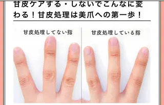 ネイル 痩身/脱毛/ネイル HARUKAのエステ・リラクイメージ