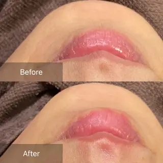 産毛専門店 Bittoのエステ・リラクイメージ