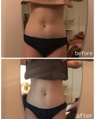 脱毛・痩身強化サロン リアンメルシー佐々木のエステ・リラクイメージ