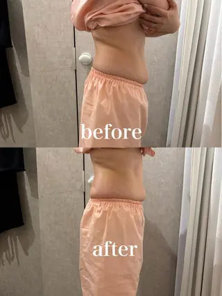 メンズ 腸活サポート みなみののエステ・リラクイメージ