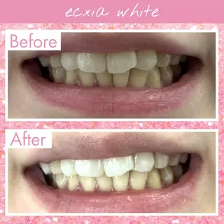 セルフホワイトニング エクシア渋谷原宿店のその他イメージ