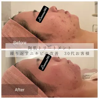 Luana ∞のエステ・リラクイメージ