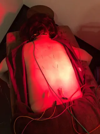 美容鍼灸整体サロンBeauJu所属・小顔矯/美容鍼/鍼灸 BeauJuのその他イメージ