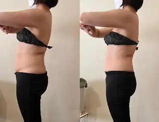 エイジングケアサロンBIOEL所属・肌質改善BIOELプ ラズマ/ラミピールのエステ・リラクイメージ