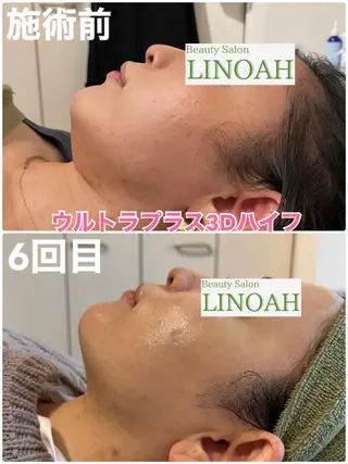 マツエク・マツパ アイブロウ メンズ ビューティーサロン リノアのエステ・リラクイメージ