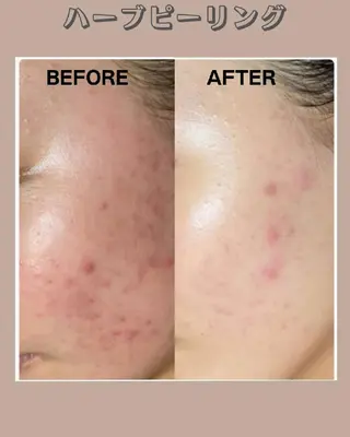 Facial Salon LUIRE所属・LUIRE　 ルイールのエステ・リラクイメージ