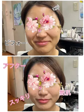 【安心ハンドテク】 メナード富田丘のエステ・リラクイメージ