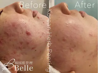 韓国肌管理Belle志木店所属・中谷 彩華のエステ・リラクイメージ