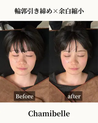 美容鍼灸サロン Chamibelleのエステ・リラクイメージ