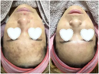 Knine所属・Knine 心斎橋店のエステ・リラクイメージ