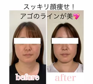 小顔と ヘッドスパのお店のエステ・リラクイメージ