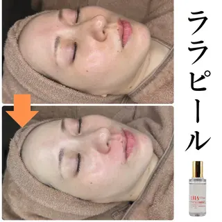 Babel 〜都度払いサロン〜のエステ・リラクイメージ