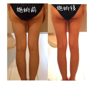 ミディアム カラー パーマ ヘアアレンジ メンズ キッズ ネイル マツエク・マツパ 強圧オールハンド痩身&黄土よもぎ蒸しプライベートサロンClematis池袋所属・強圧オールハンド痩身 片野のエステ・リラクイメージ