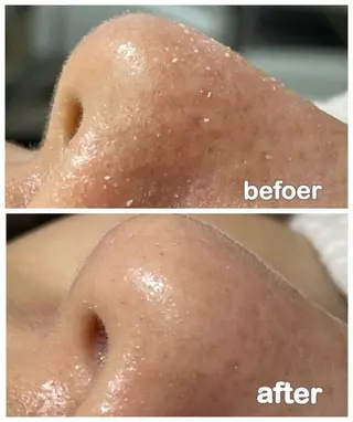 エステルーム　ラティア所属・今井 登美子のエステ・リラクイメージ