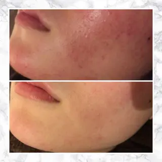 触れたくなる モテ肌へ...❤︎のエステ・リラクイメージ