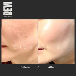 Bevi salonのその他イメージ