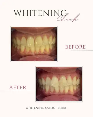 ホワイトニングサロン Ecru所属・ホワイトニングサロン Ecru エクリュのその他イメージ