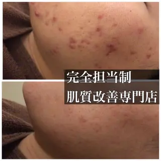 ミディアム カラー パーマ ヘアアレンジ メンズ キッズ ネイル マツエク・マツパ ニキビ・肌質改善専門 ♡人生が変わるサロンのエステ・リラクイメージ