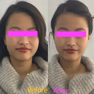 小顔美肌&痩身ｻﾛﾝ My Timeのエステ・リラクイメージ