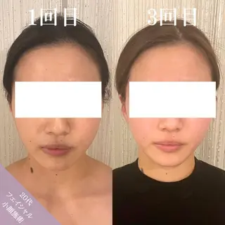 Be-joux 【ビジュー】のエステ・リラクイメージ