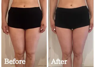 リプラス整体院所属・Re+(リプラス整体 院:やまみち)のエステ・リラクイメージ