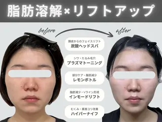 aimer 栄店のエステ・リラクイメージ