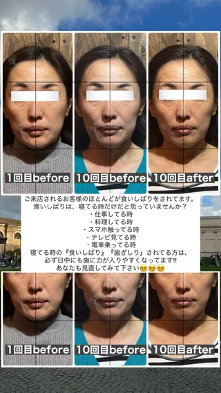 💎後悔させない小顔 矯正💎イトヤマ🌱のエステ・リラクイメージ