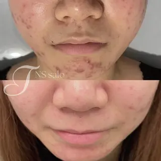 ナスサロ所属・💖韓国肌管理 :美容看護師/T🪽のエステ・リラクイメージ