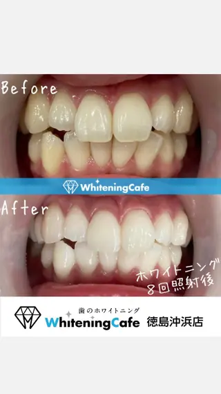 ホワイトニングカフェ徳島沖浜店所属・ホワイトニングカフェ 徳島沖浜店のエステ・リラクイメージ