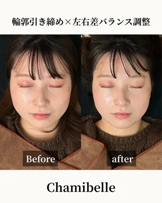 美容鍼灸サロン Chamibelleのエステ・リラクイメージ