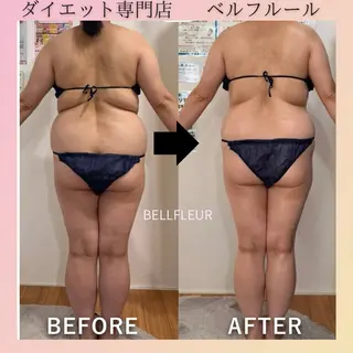 ベルフルール所属・鈴木 悠佳梨のエステ・リラクイメージ