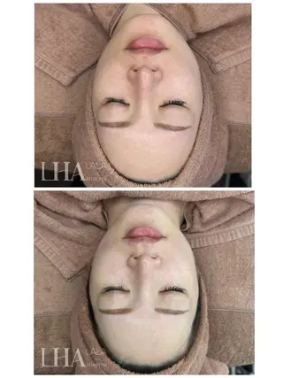 ぷるる 練馬のエステ・リラクイメージ