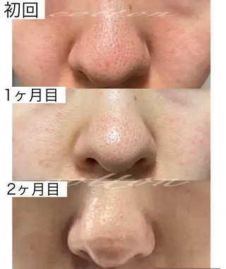 都度払い 肌質改善専門サロンのエステ・リラクイメージ