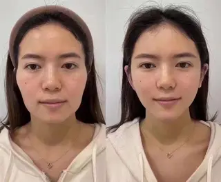 マツエク・マツパ aliaハイフ&水光ジェットサロン所属・aliaハーブ水光店 エステティシャン募集のエステ・リラクイメージ