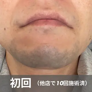 メンズ GLOW by MKのエステ・リラクイメージ