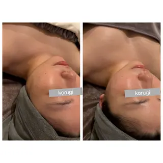 ☆痩身/小顔☆ ハイパーナイフexのエステ・リラクイメージ